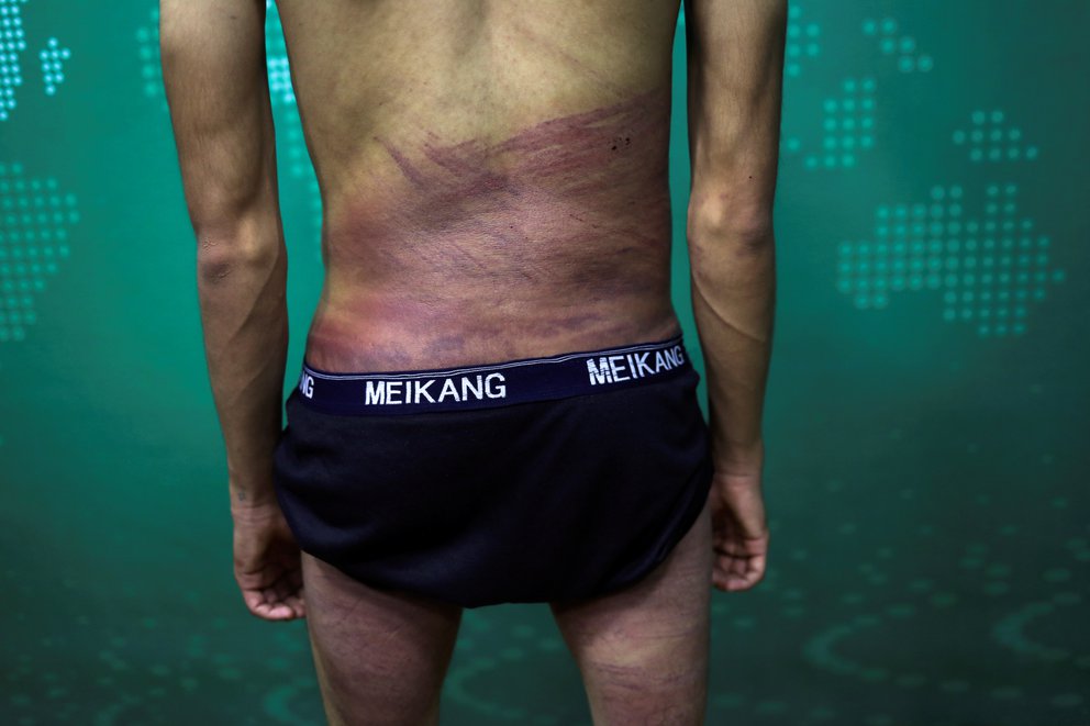 periodistas golpeado