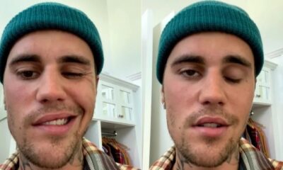Justin Bieber parálisis