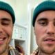Justin Bieber parálisis