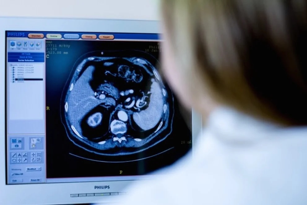 hormonas cáncer próstata