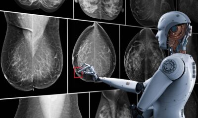 Son confiables los resultados que Vara llama normales, o no Así parece. Según Thilo Töllner, radiólogo de cáncer de mama en un centro de Alemania, “lo normal es casi siempre normal”. De esta forma, admite dedicar más tiempo a diseccionar los hallazgos positivos de la inteligencia que los hallazgos que califica de “normales”. Hoy en día, la IA ya se utiliza en centros especializados en detección de cáncer en Alemania. Además, este año vio sus apariciones en un importante hospital de México y otro en Grecia. El plan, por supuesto, es llevar esta inteligencia revolucionaria a todos los rincones del mundo, y es gratificante ver qué se toman estas tecnologías para el aporte a la humanidad.