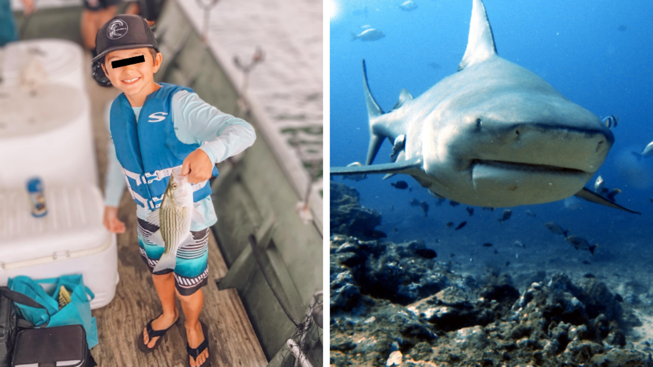 amputan pierna tiburón