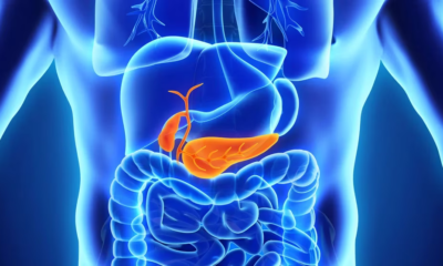 inflamación vesícula